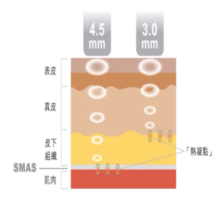 快速消除雙下巴